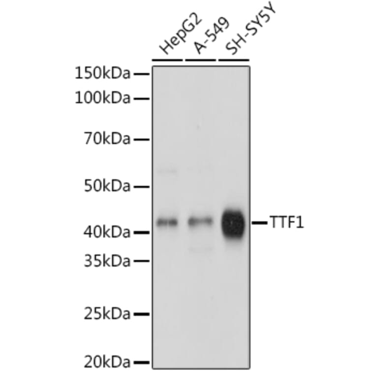 Western Blot - Anti-TTF1 Antibody [ARC1942] (A307805) - Antibodies.com