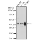 Western Blot - Anti-TTF1 Antibody [ARC1942] (A307805) - Antibodies.com