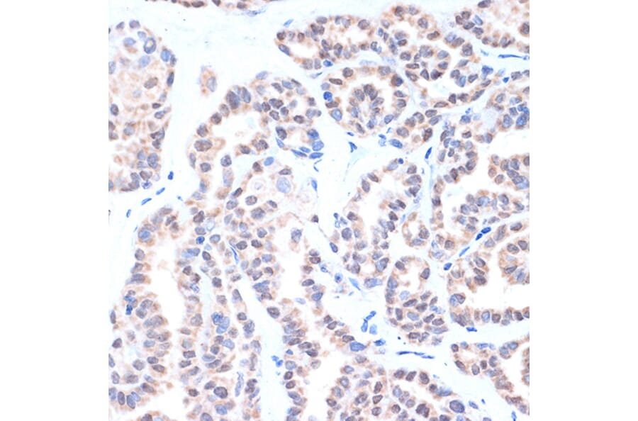 Immunohistochemistry - Anti-TTF1 Antibody [ARC1942] (A307805) - Antibodies.com