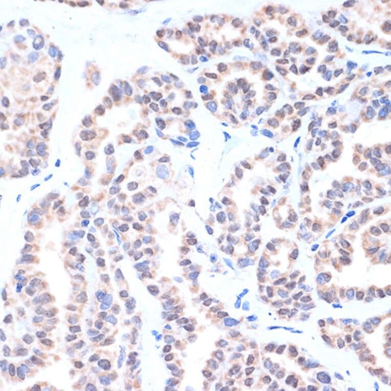 Immunohistochemistry - Anti-TTF1 Antibody [ARC1942] (A307805) - Antibodies.com