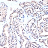 Immunohistochemistry - Anti-TTF1 Antibody [ARC1942] (A307805) - Antibodies.com