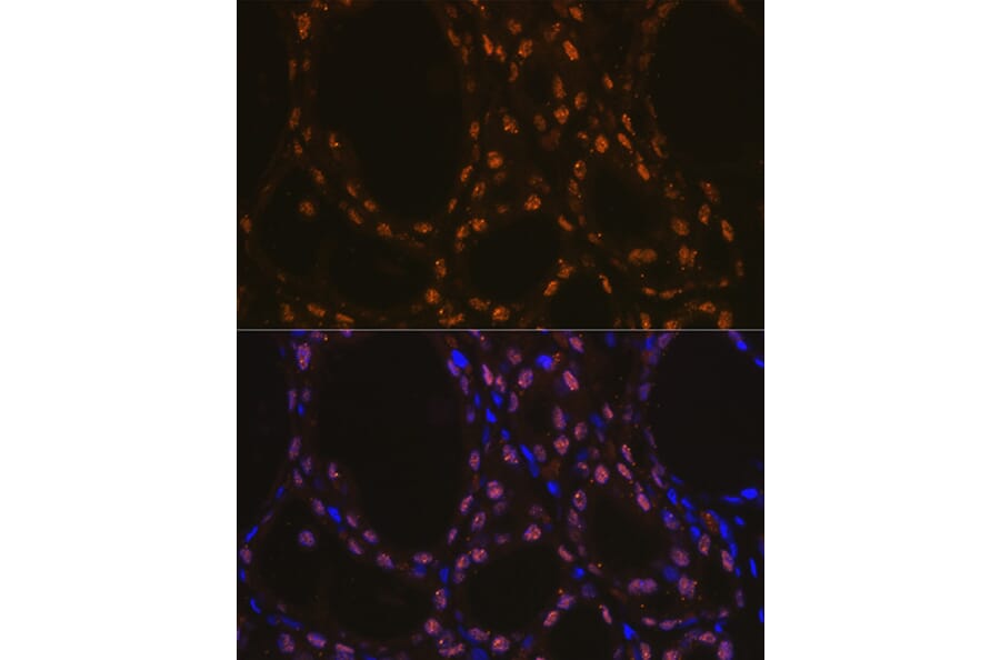 Immunofluorescence - Anti-TTF1 Antibody [ARC1942] (A307805) - Antibodies.com
