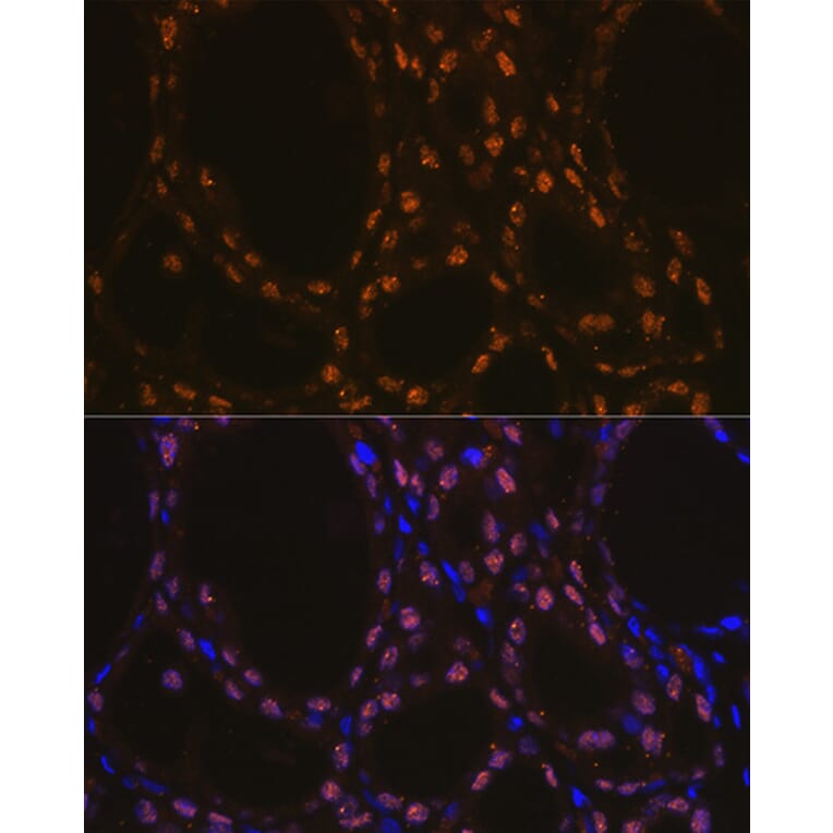 Immunofluorescence - Anti-TTF1 Antibody [ARC1942] (A307805) - Antibodies.com