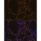 Immunofluorescence - Anti-TTF1 Antibody [ARC1942] (A307805) - Antibodies.com