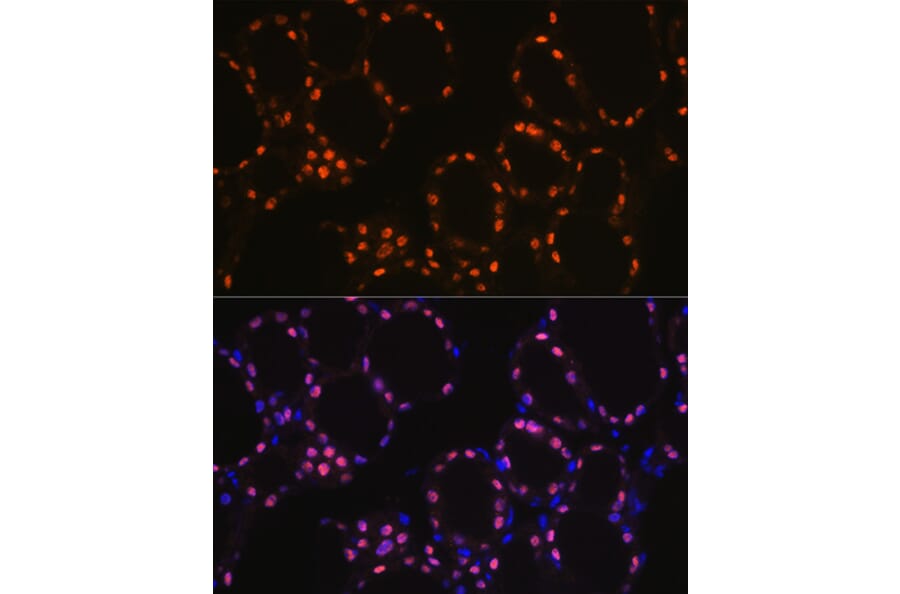 Immunofluorescence - Anti-TTF1 Antibody [ARC1942] (A307805) - Antibodies.com