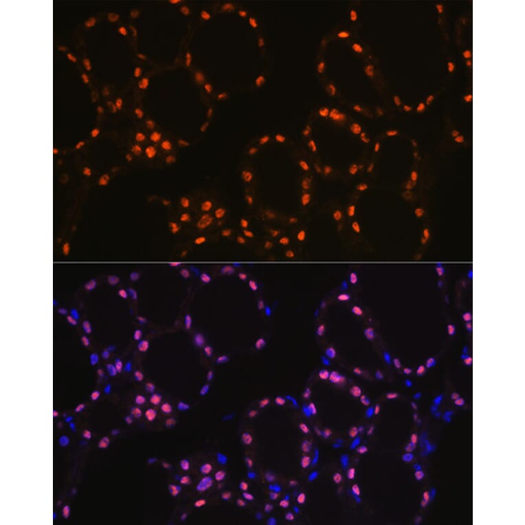 Immunofluorescence - Anti-TTF1 Antibody [ARC1942] (A307805) - Antibodies.com