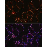 Immunofluorescence - Anti-TTF1 Antibody [ARC1942] (A307805) - Antibodies.com