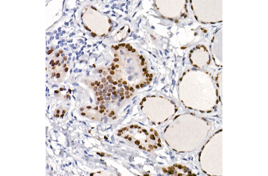 Immunohistochemistry - Anti-TTF1 Antibody [ARC2744] (A307806) - Antibodies.com