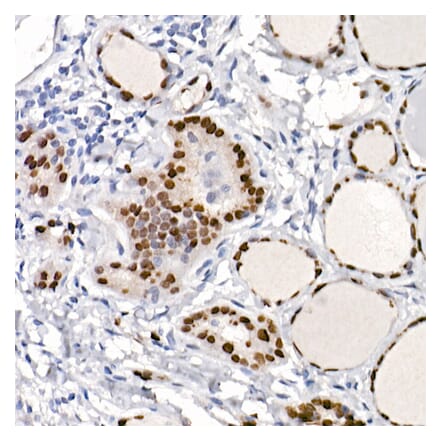 Immunohistochemistry - Anti-TTF1 Antibody [ARC2744] (A307806) - Antibodies.com