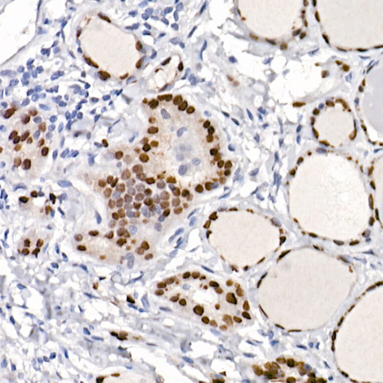 Immunohistochemistry - Anti-TTF1 Antibody [ARC2744] (A307806) - Antibodies.com
