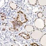 Immunohistochemistry - Anti-TTF1 Antibody [ARC2744] (A307806) - Antibodies.com