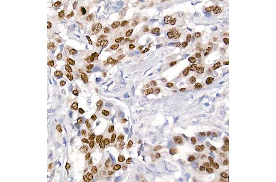 Immunohistochemistry - Anti-TTF1 Antibody [ARC2744] (A307806) - Antibodies.com