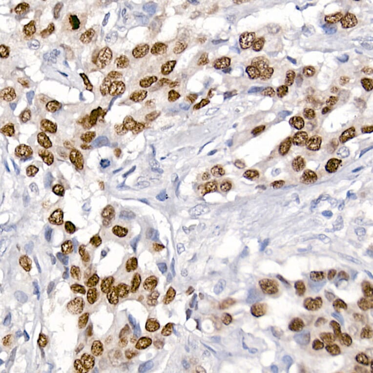 Immunohistochemistry - Anti-TTF1 Antibody [ARC2744] (A307806) - Antibodies.com