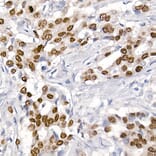 Immunohistochemistry - Anti-TTF1 Antibody [ARC2744] (A307806) - Antibodies.com