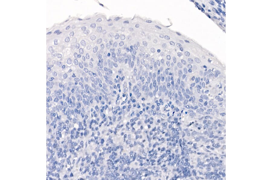 Immunohistochemistry - Anti-TTF1 Antibody [ARC2744] (A307806) - Antibodies.com