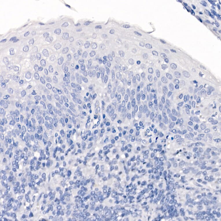 Immunohistochemistry - Anti-TTF1 Antibody [ARC2744] (A307806) - Antibodies.com