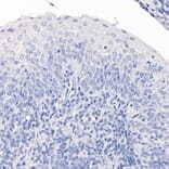 Immunohistochemistry - Anti-TTF1 Antibody [ARC2744] (A307806) - Antibodies.com