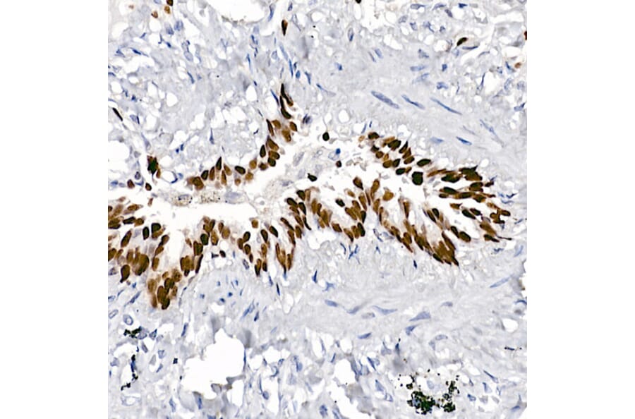 Immunohistochemistry - Anti-TTF1 Antibody [ARC2744] (A307806) - Antibodies.com
