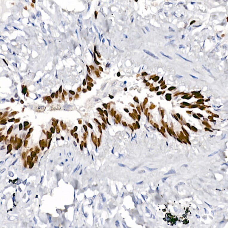 Immunohistochemistry - Anti-TTF1 Antibody [ARC2744] (A307806) - Antibodies.com