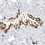 Immunohistochemistry - Anti-TTF1 Antibody [ARC2744] (A307806) - Antibodies.com