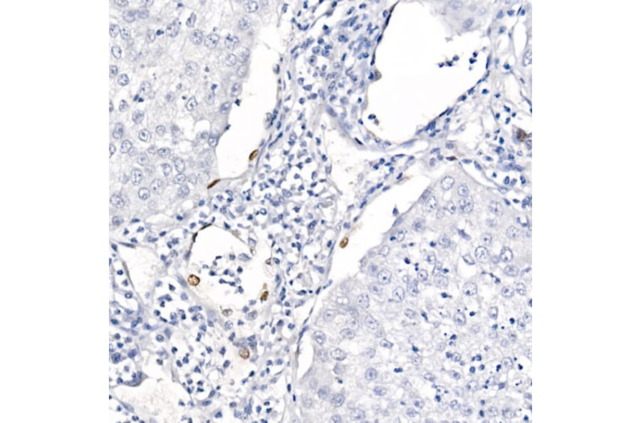 Immunohistochemistry - Anti-TTF1 Antibody [ARC2744] (A307806) - Antibodies.com