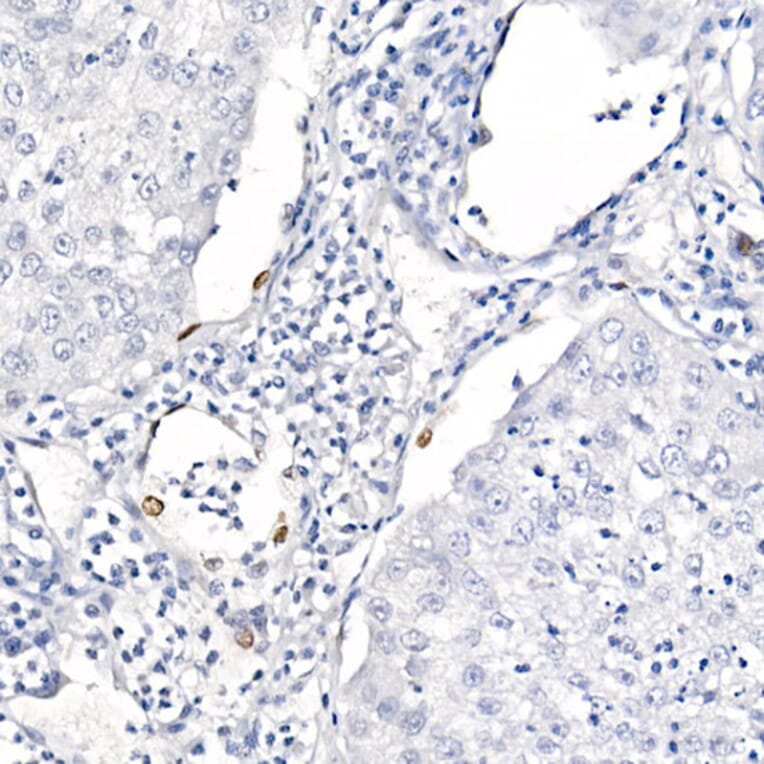 Immunohistochemistry - Anti-TTF1 Antibody [ARC2744] (A307806) - Antibodies.com