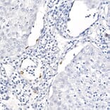 Immunohistochemistry - Anti-TTF1 Antibody [ARC2744] (A307806) - Antibodies.com