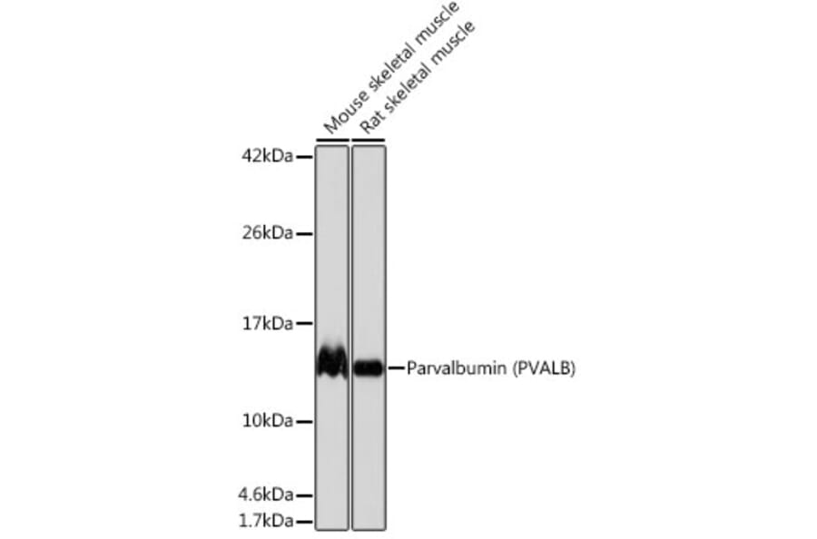 Western Blot - Anti-Parvalbumin Antibody [ARC0385] (A307807) - Antibodies.com