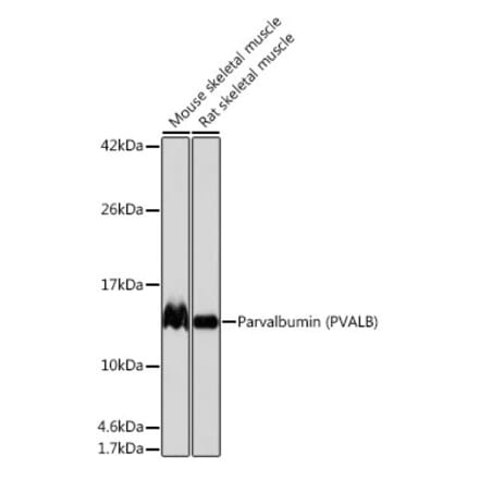 Western Blot - Anti-Parvalbumin Antibody [ARC0385] (A307807) - Antibodies.com