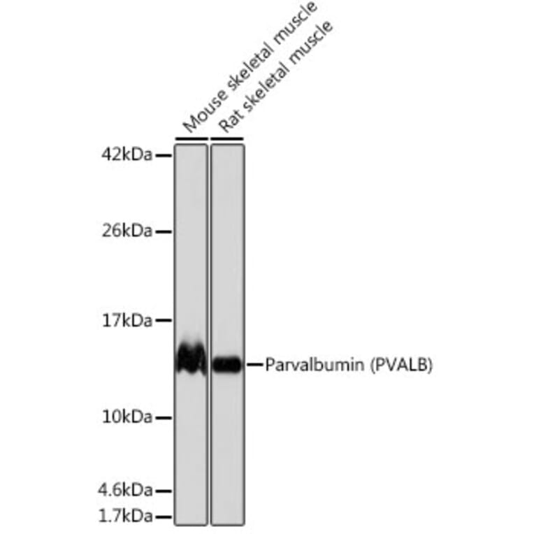 Western Blot - Anti-Parvalbumin Antibody [ARC0385] (A307807) - Antibodies.com
