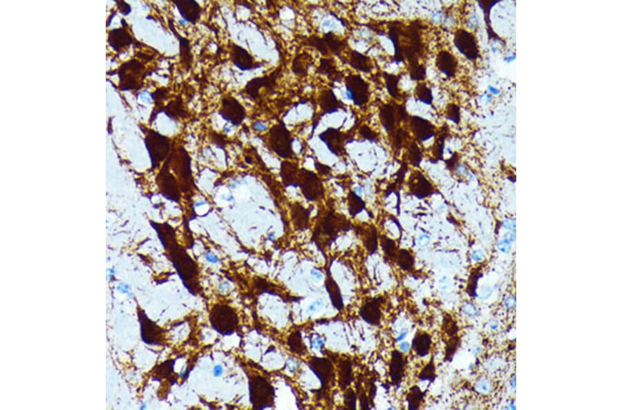 Immunohistochemistry - Anti-Parvalbumin Antibody [ARC0385] (A307807) - Antibodies.com