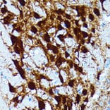 Immunohistochemistry - Anti-Parvalbumin Antibody [ARC0385] (A307807) - Antibodies.com