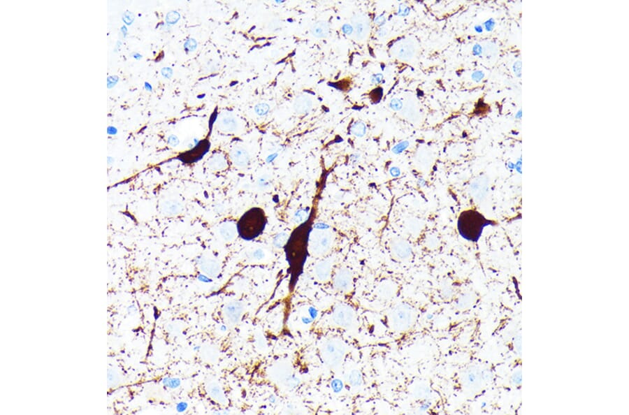 Immunohistochemistry - Anti-Parvalbumin Antibody [ARC0385] (A307807) - Antibodies.com