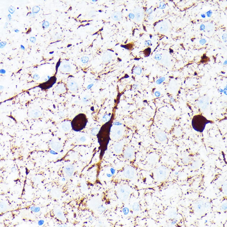 Immunohistochemistry - Anti-Parvalbumin Antibody [ARC0385] (A307807) - Antibodies.com
