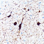 Immunohistochemistry - Anti-Parvalbumin Antibody [ARC0385] (A307807) - Antibodies.com