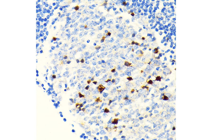Immunohistochemistry - Anti-Parvalbumin Antibody [ARC0385] (A307807) - Antibodies.com