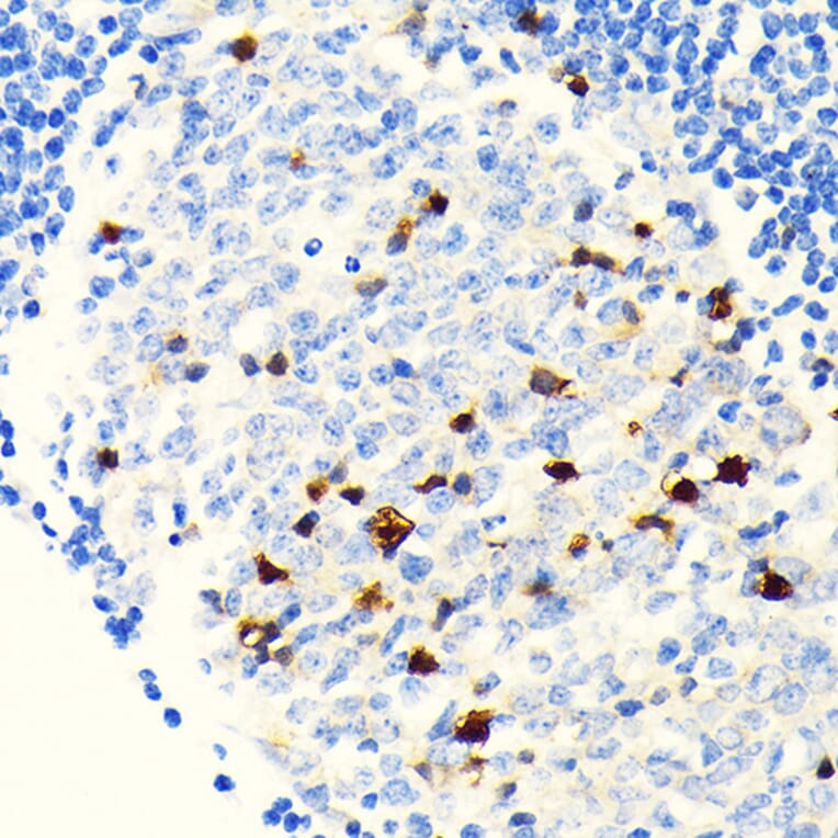 Immunohistochemistry - Anti-Parvalbumin Antibody [ARC0385] (A307807) - Antibodies.com