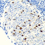 Immunohistochemistry - Anti-Parvalbumin Antibody [ARC0385] (A307807) - Antibodies.com