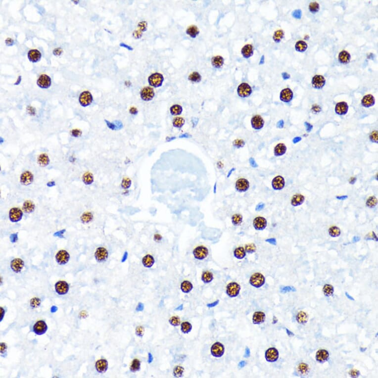 Immunohistochemistry - Anti-HuR / ELAVL1 Antibody [ARC0101] (A307808) - Antibodies.com