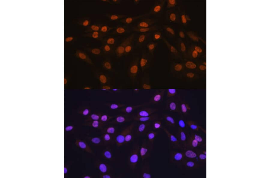 Immunofluorescence - Anti-HuR/ELAVL1 Antibody [ARC0101] (A307808) - Antibodies.com