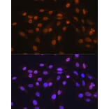 Immunofluorescence - Anti-HuR / ELAVL1 Antibody [ARC0101] (A307808) - Antibodies.com