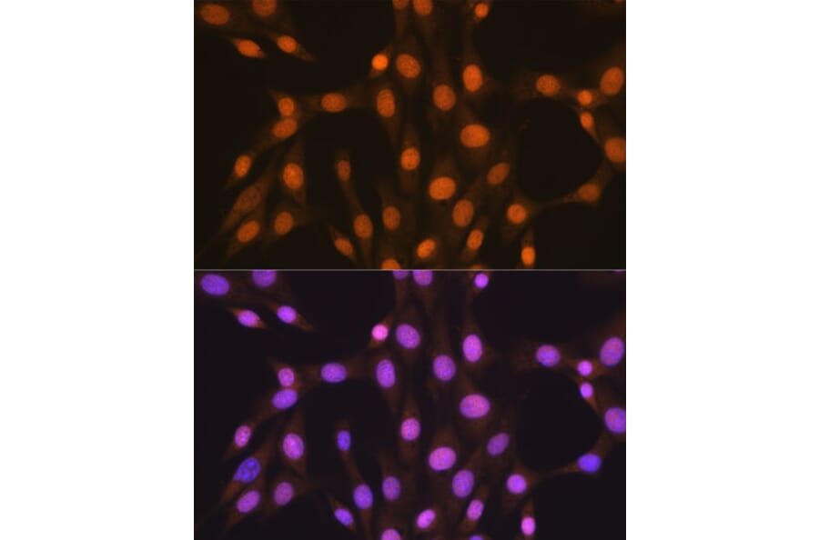 Immunofluorescence - Anti-HuR/ELAVL1 Antibody [ARC0101] (A307808) - Antibodies.com