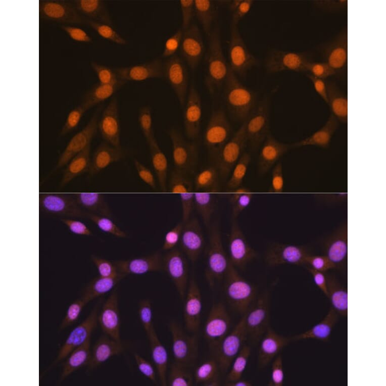 Immunofluorescence - Anti-HuR / ELAVL1 Antibody [ARC0101] (A307808) - Antibodies.com