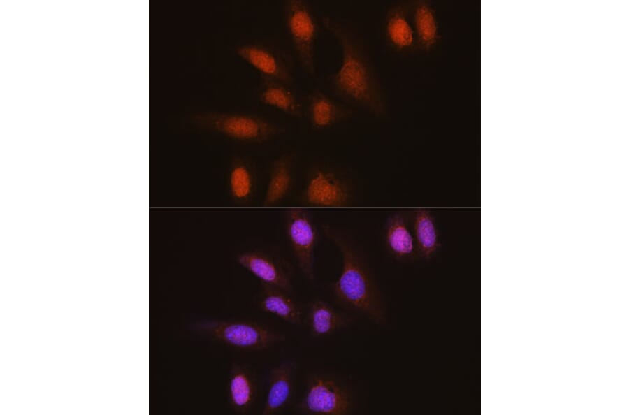 Immunofluorescence - Anti-HuR/ELAVL1 Antibody [ARC0101] (A307808) - Antibodies.com