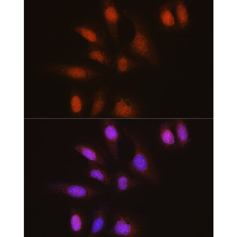 Immunofluorescence - Anti-HuR / ELAVL1 Antibody [ARC0101] (A307808) - Antibodies.com