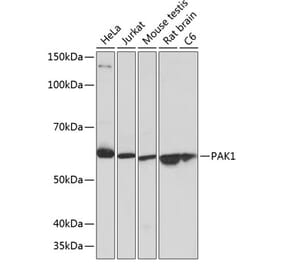Western Blot - Anti-PAK1 Antibody [ARC0087] (A307809) - Antibodies.com