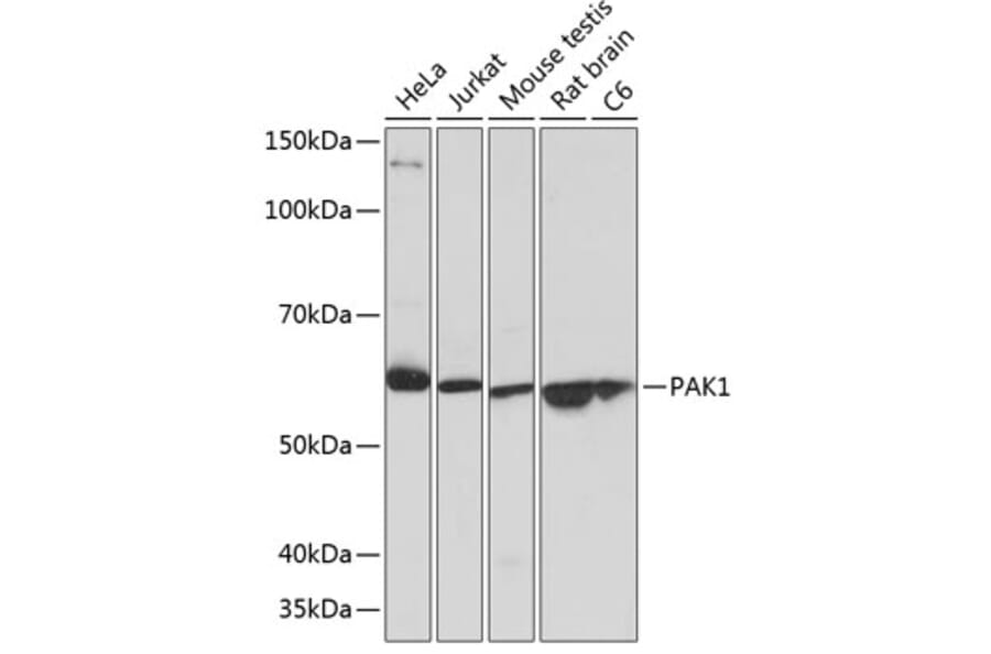Western Blot - Anti-PAK1 Antibody [ARC0087] (A307809) - Antibodies.com