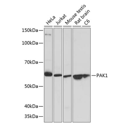 Western Blot - Anti-PAK1 Antibody [ARC0087] (A307809) - Antibodies.com