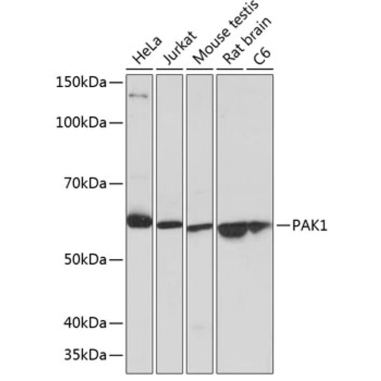Western Blot - Anti-PAK1 Antibody [ARC0087] (A307809) - Antibodies.com