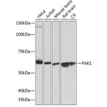 Western Blot - Anti-PAK1 Antibody [ARC0087] (A307809) - Antibodies.com
